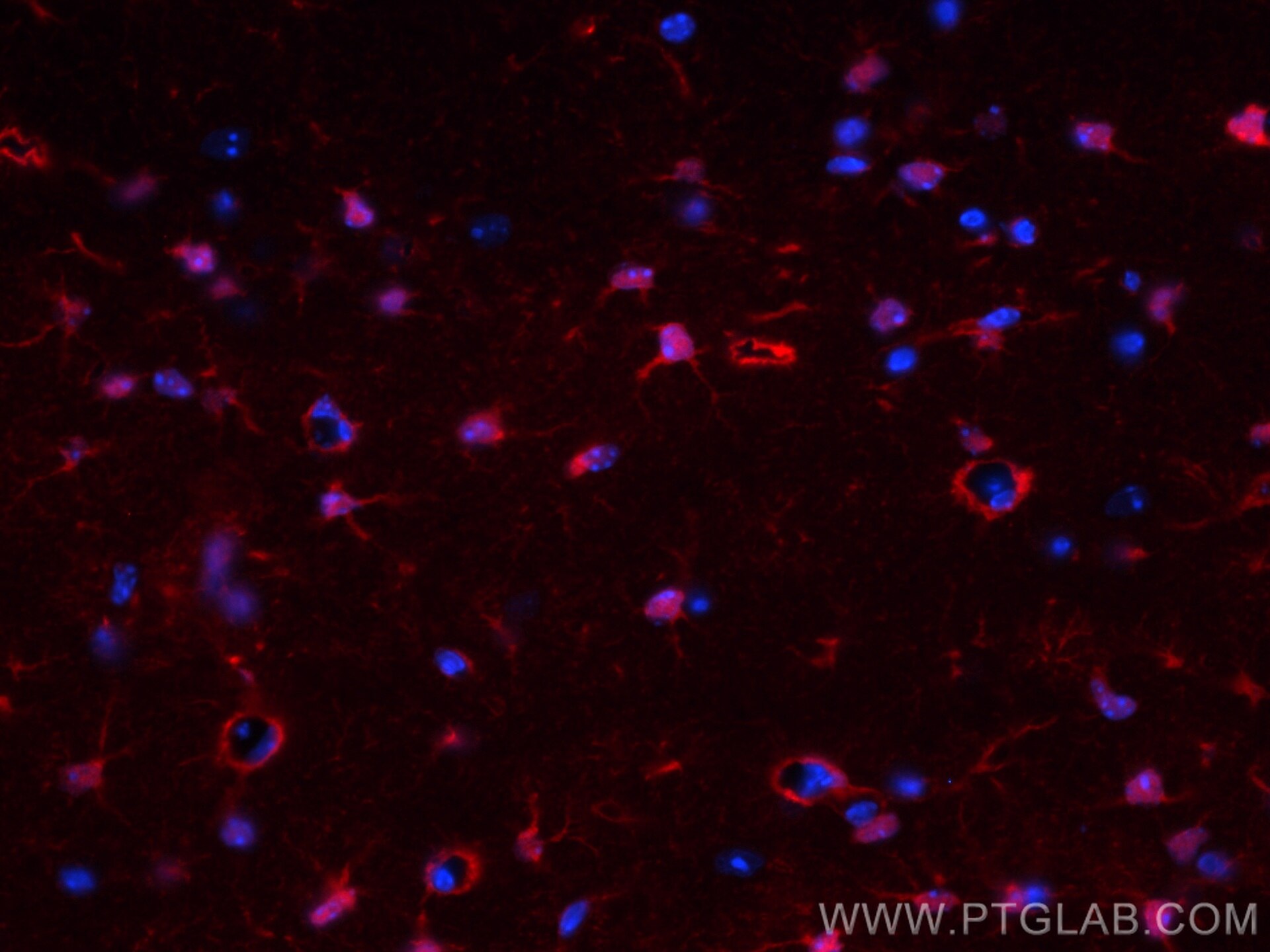 Immunofluorescence (IF) / fluorescent staining of mouse brain tissue using CoraLite®594-conjugated S100 Beta Polyclonal antib (CL594-15146)