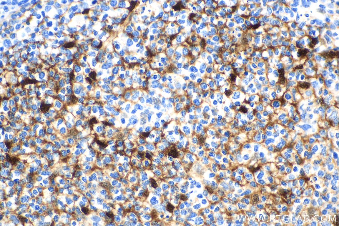 Immunohistochemistry (IHC) staining of human tonsillitis tissue using S100A1 Polyclonal antibody (16027-1-AP)