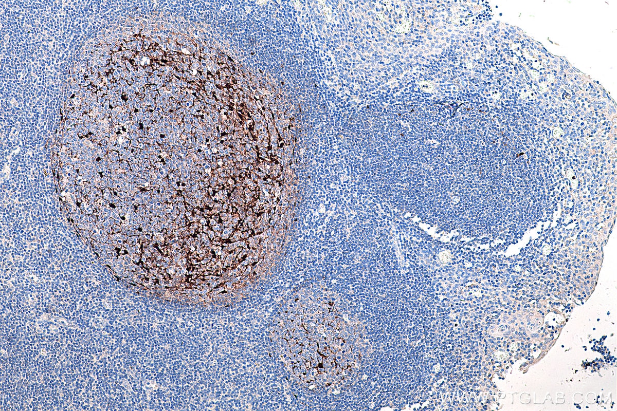 Immunohistochemistry (IHC) staining of human tonsillitis tissue using S100A1 Polyclonal antibody (16027-1-AP)