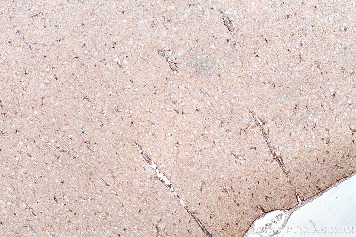 Immunohistochemistry (IHC) staining of rat brain tissue using S100A1 Polyclonal antibody (16027-1-AP)