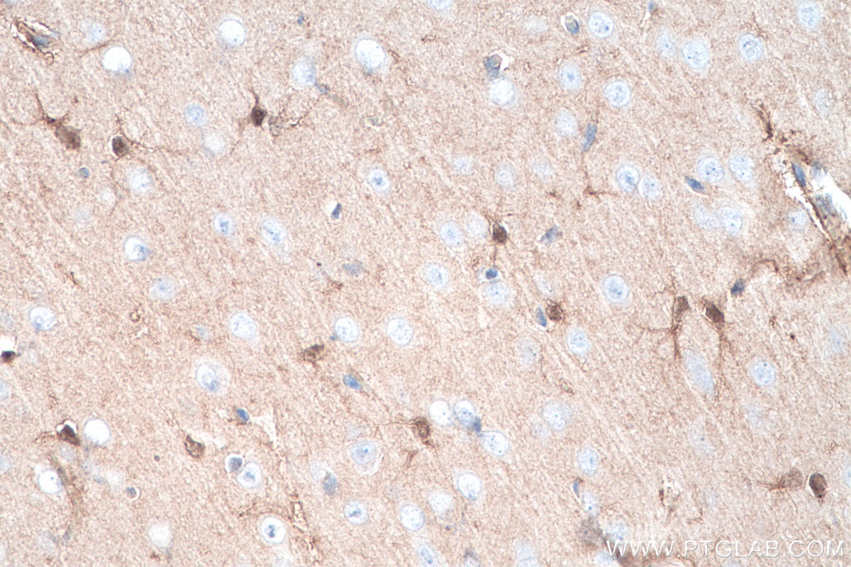 IHC staining of rat brain using 16027-1-AP