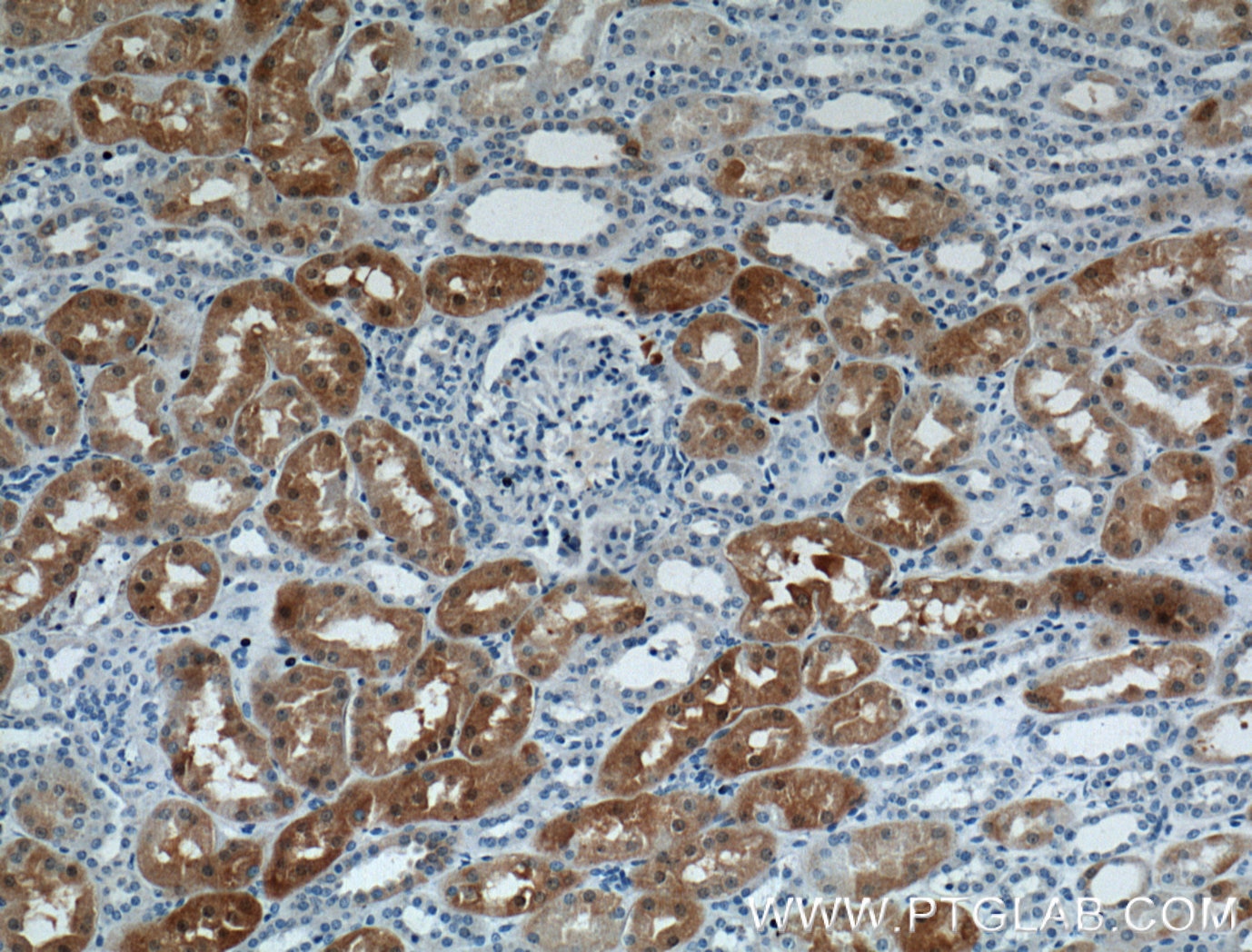 Immunohistochemistry (IHC) staining of human kidney tissue using S100A1 Polyclonal antibody (16027-1-AP)