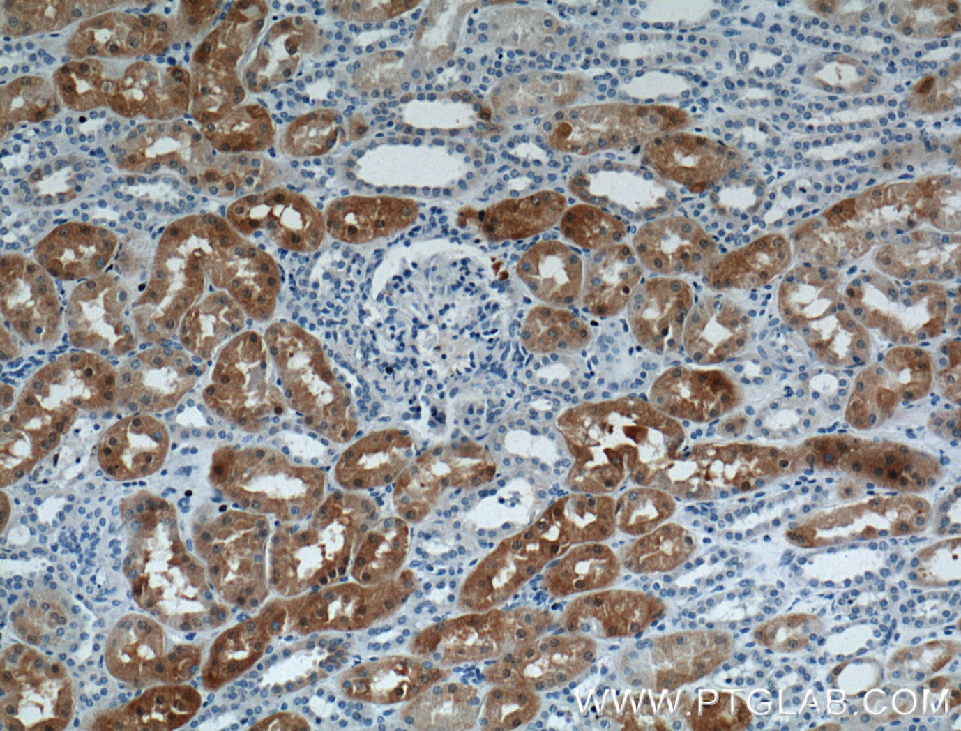 IHC staining of human kidney using 16027-1-AP