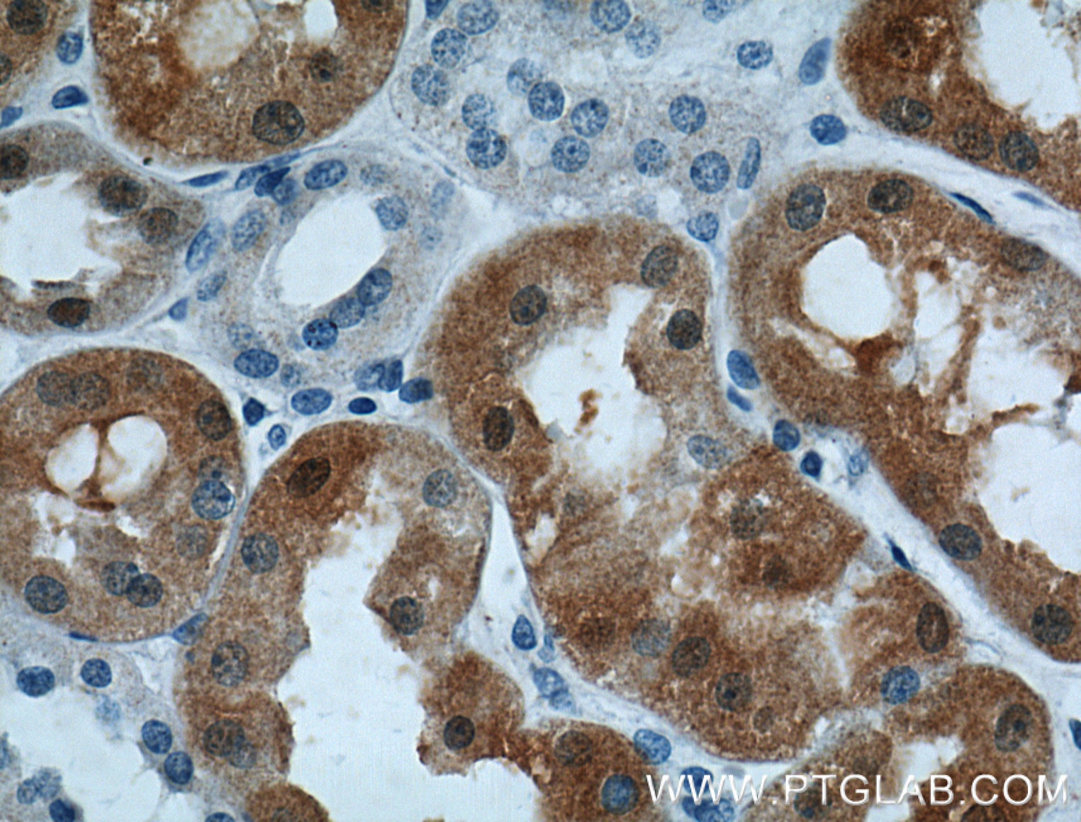 Immunohistochemistry (IHC) staining of human kidney tissue using S100A1 Polyclonal antibody (16027-1-AP)