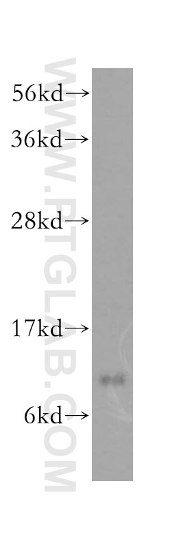 Western Blot (WB) analysis of human heart tissue using S100A1 Polyclonal antibody (16027-1-AP)