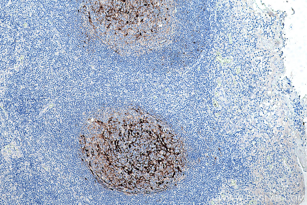 Immunohistochemistry (IHC) staining of human tonsillitis tissue using S100A1 Monoclonal antibody (67237-1-Ig)
