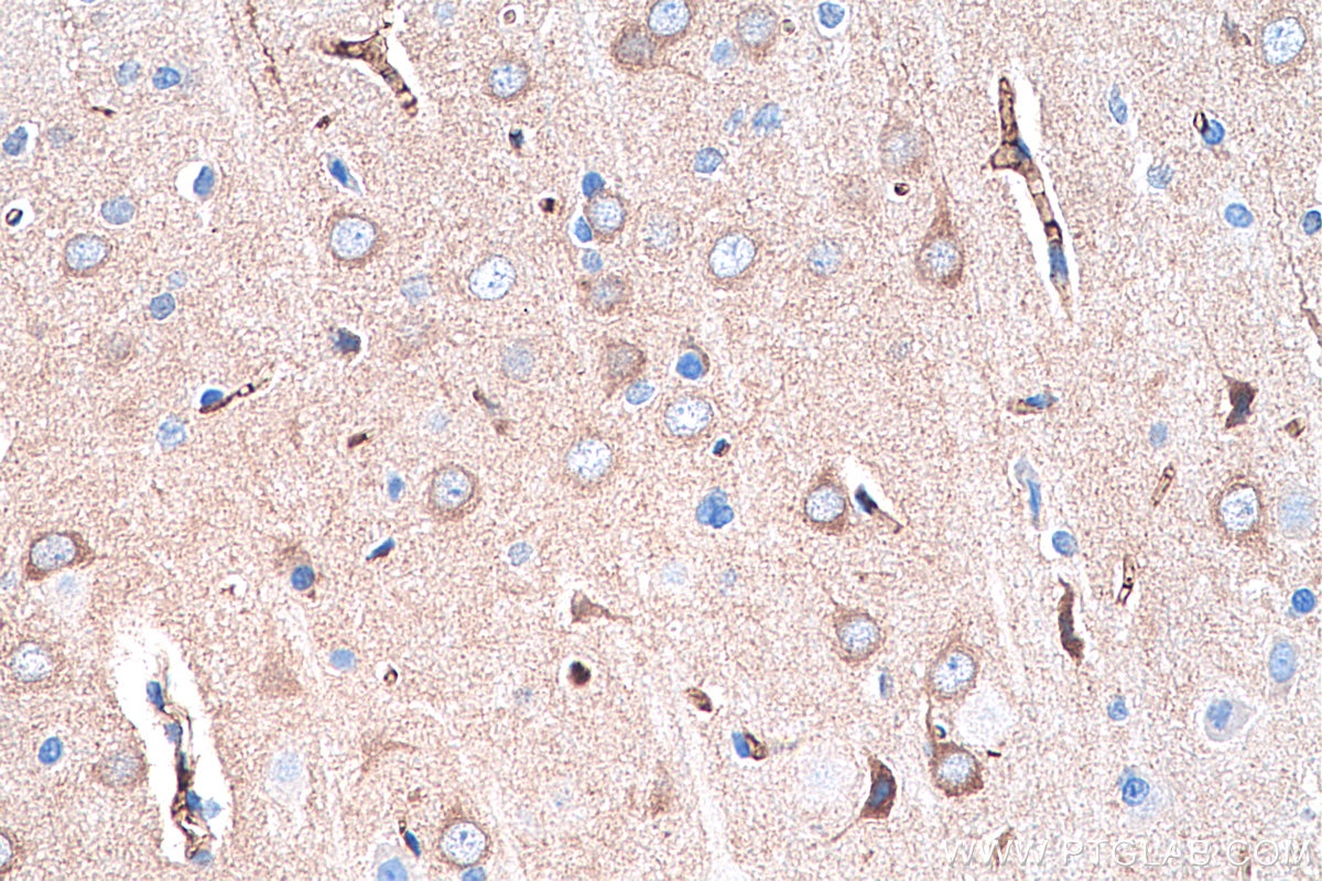 Immunohistochemistry (IHC) staining of rat brain tissue using S100A1 Monoclonal antibody (67237-1-Ig)
