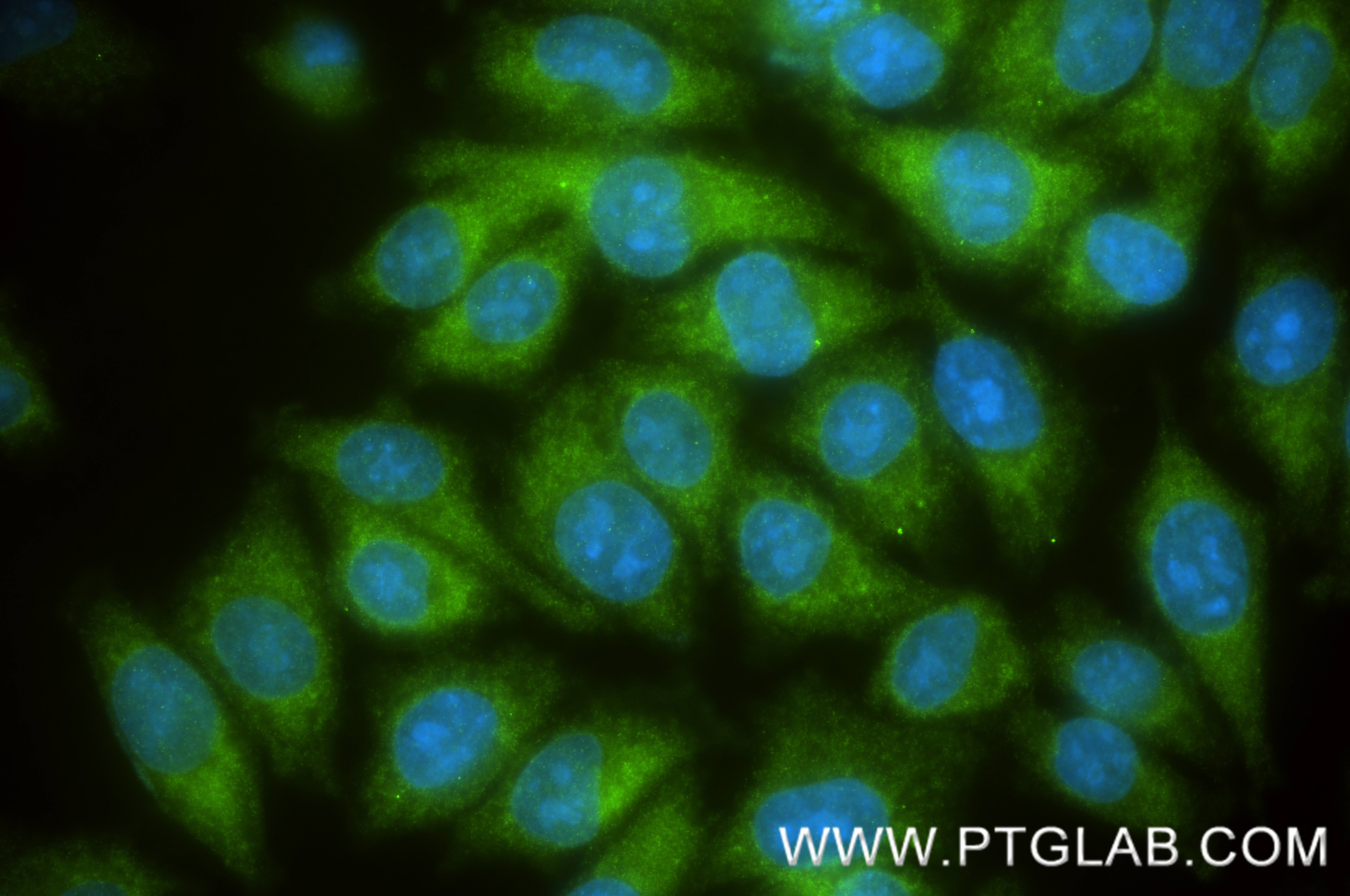 Immunofluorescence (IF) / fluorescent staining of A375 cells using S100A1 Recombinant monoclonal antibody (88164-1-RR)