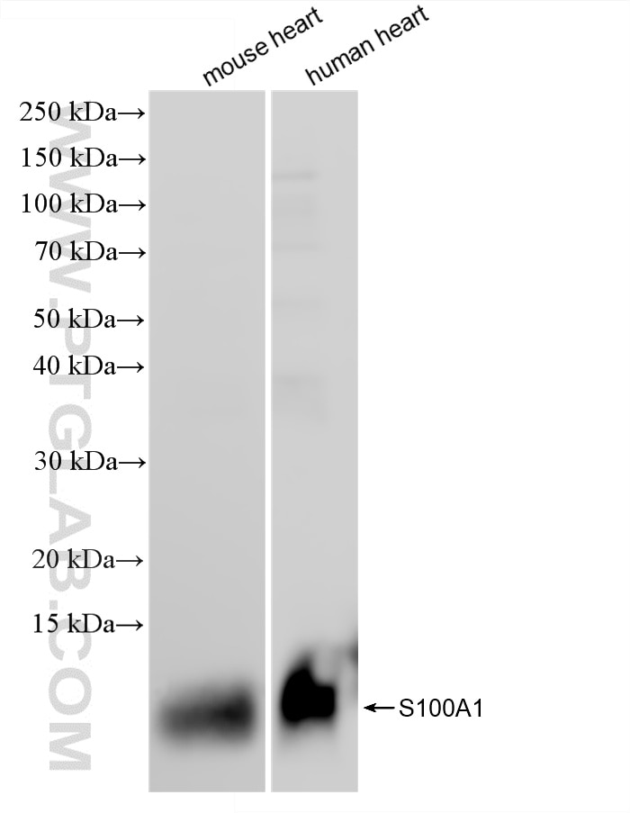 Western Blot (WB) analysis of various lysates using S100A1 Recombinant monoclonal antibody (88164-1-RR)