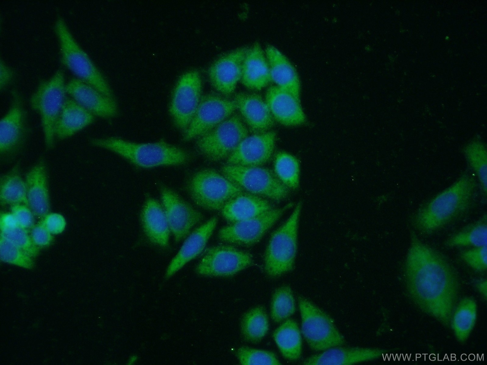 Immunofluorescence (IF) / fluorescent staining of HeLa cells using S100A10 Polyclonal antibody (11250-1-AP)