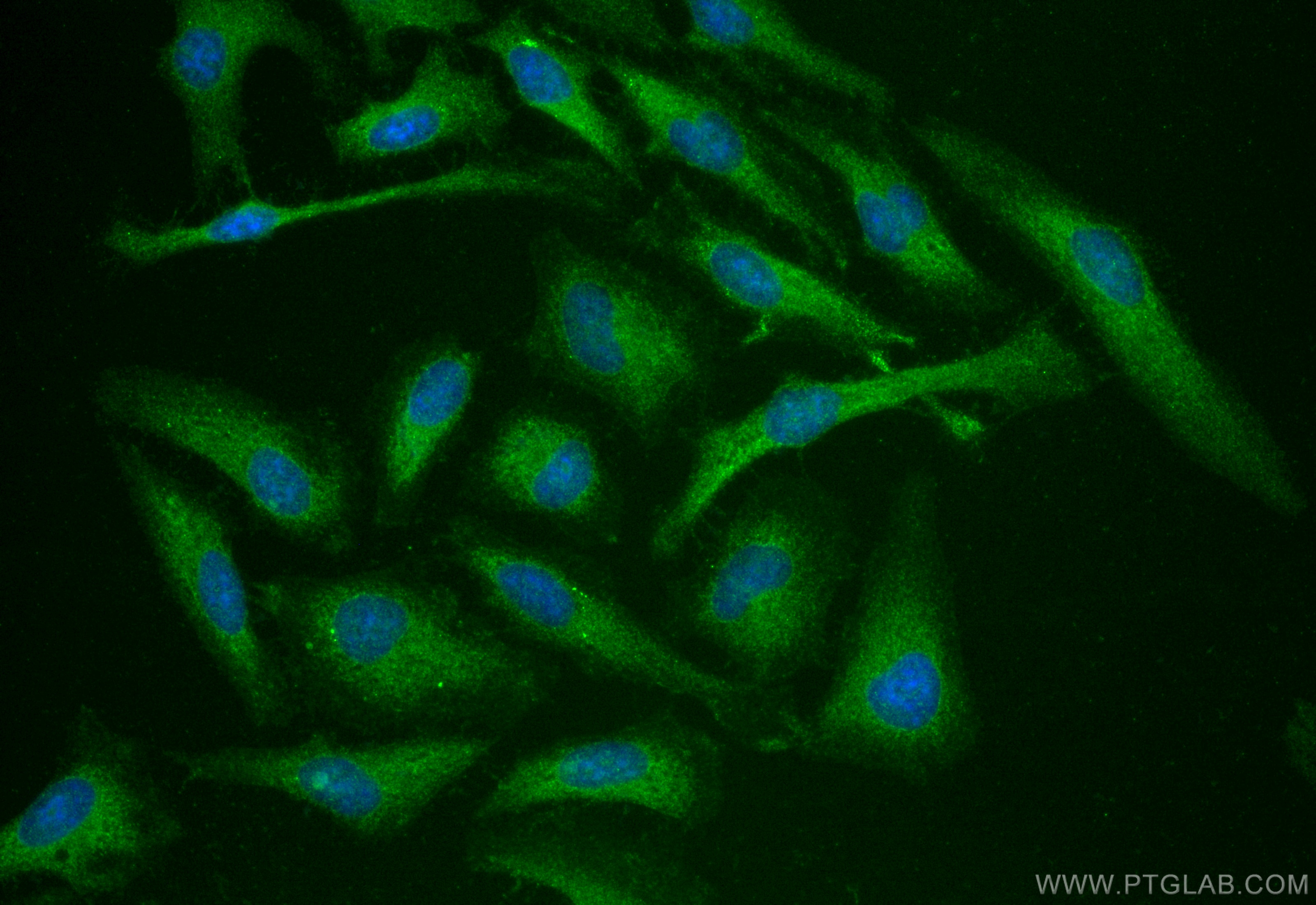 Immunofluorescence (IF) / fluorescent staining of HeLa cells using S100A10 Polyclonal antibody (11250-1-AP)