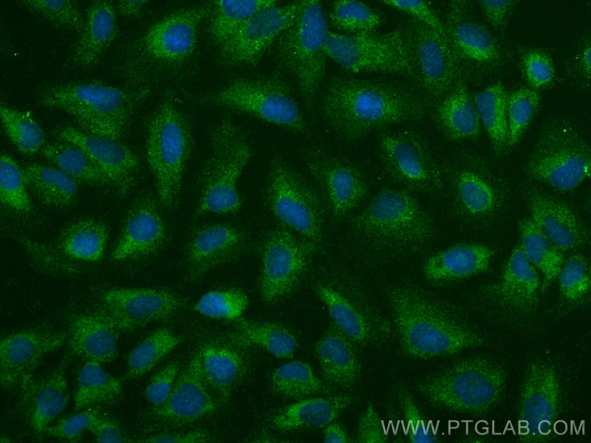 Immunofluorescence (IF) / fluorescent staining of U2OS cells using S100A10 Polyclonal antibody (11250-1-AP)