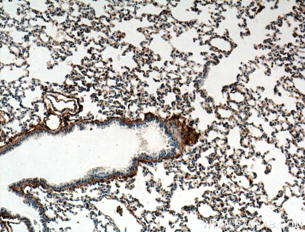 IHC staining of mouse lung using 11250-1-AP