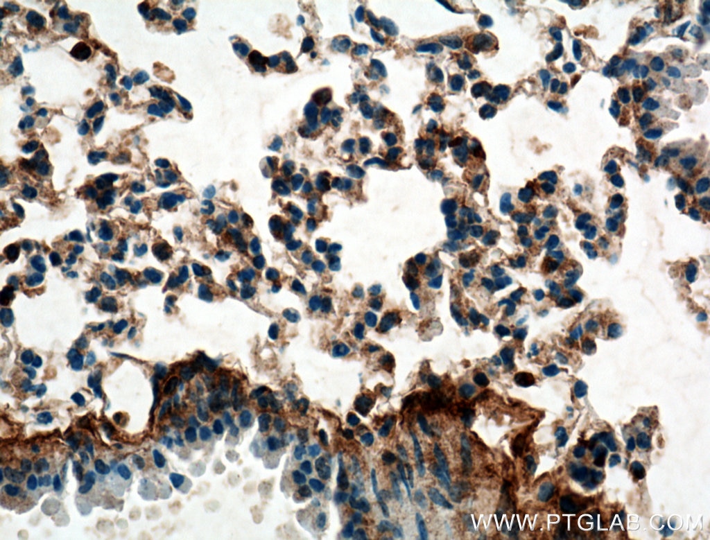 IHC staining of mouse lung using 11250-1-AP