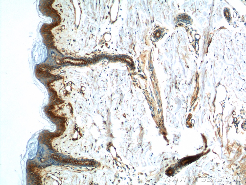 Immunohistochemistry (IHC) staining of human skin tissue using S100A10 Polyclonal antibody (11250-1-AP)