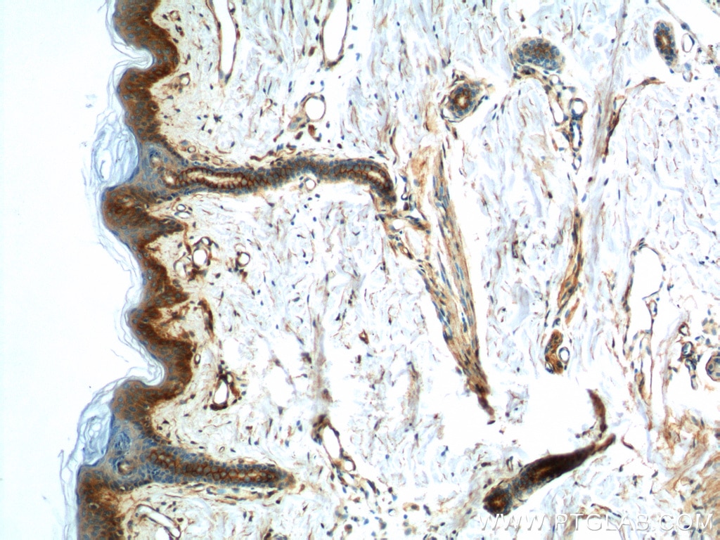 IHC staining of human skin using 11250-1-AP