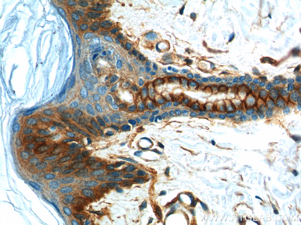 Immunohistochemistry (IHC) staining of human skin tissue using S100A10 Polyclonal antibody (11250-1-AP)