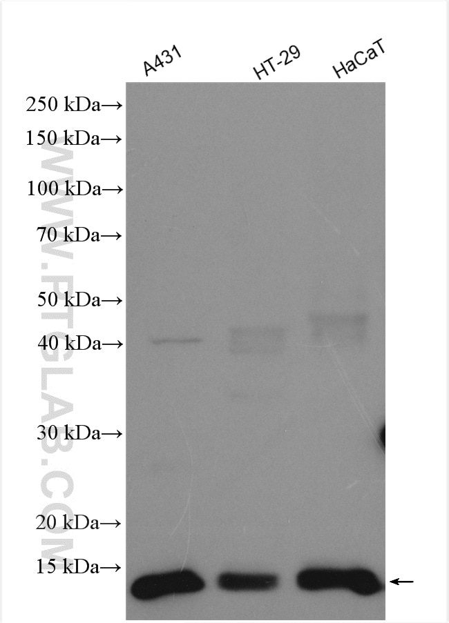 Western Blot (WB) analysis of various lysates using S100A10 Polyclonal antibody (11250-1-AP)