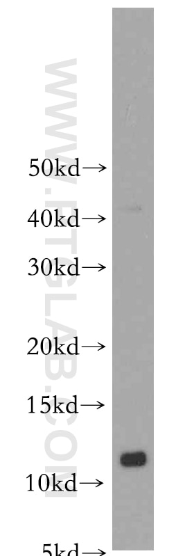 S100A10 Polyclonal antibody