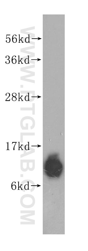 WB analysis of human lung using 11250-1-AP