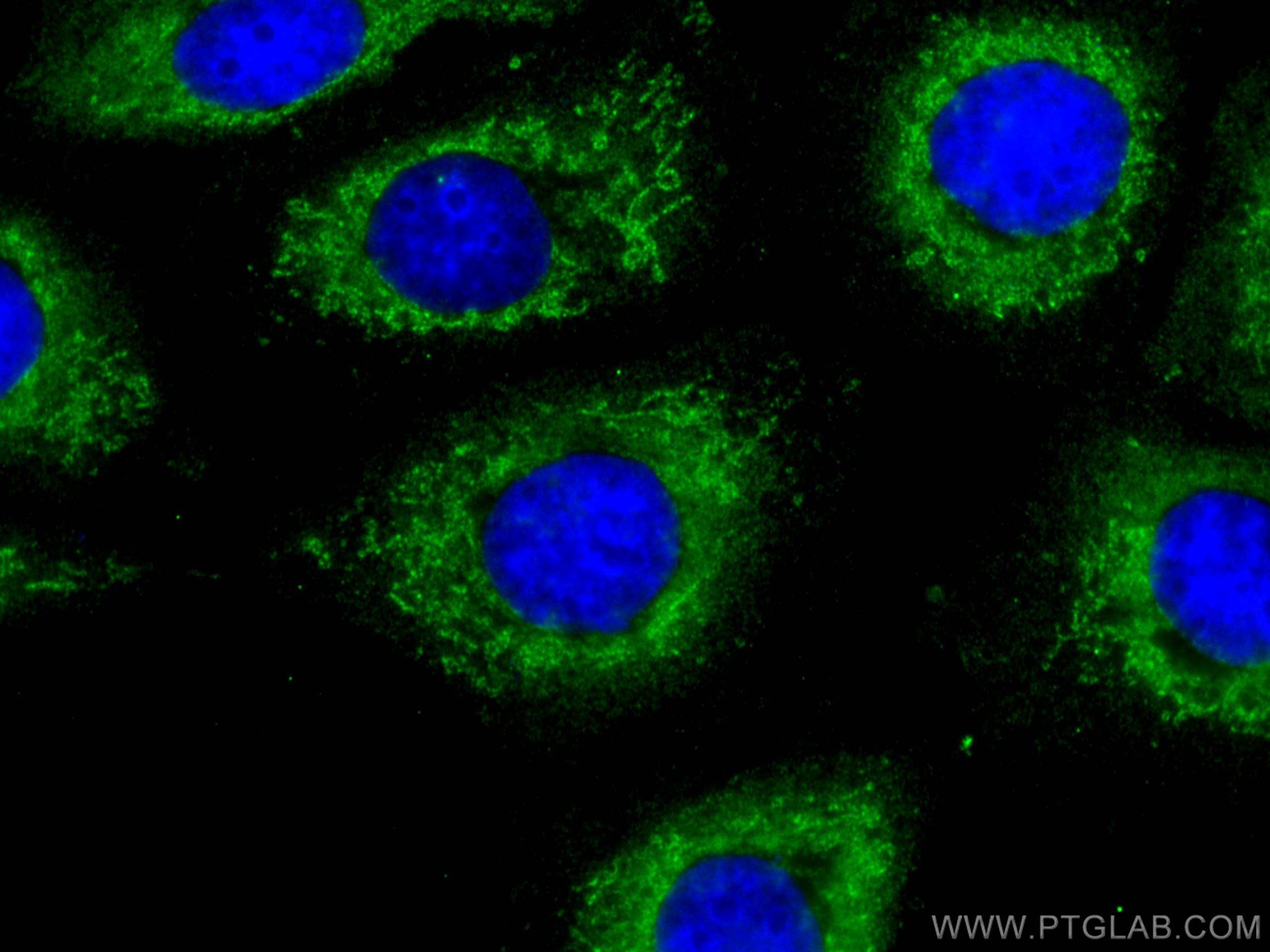 Immunofluorescence (IF) / fluorescent staining of A431 cells using S100A10 Monoclonal antibody (66227-1-Ig)