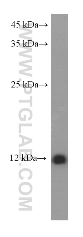 Western Blot (WB) analysis of human lung tissue using S100A10 Monoclonal antibody (66227-1-Ig)