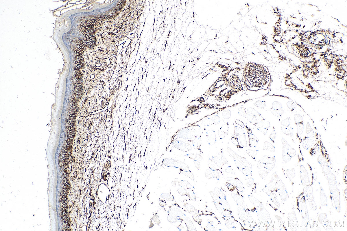 IHC staining of mouse skin using 81017-1-RR