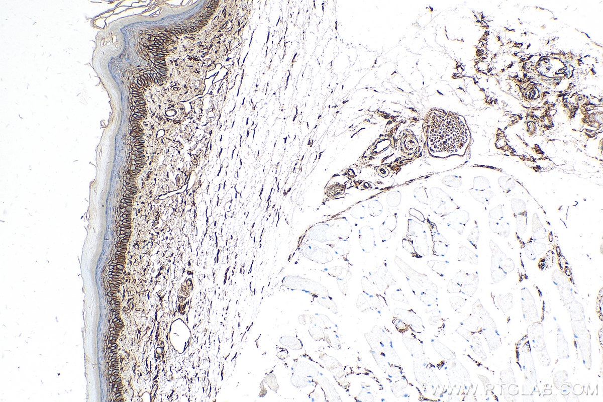 Immunohistochemistry (IHC) staining of mouse skin tissue using S100A10 Recombinant antibody (81017-1-RR)