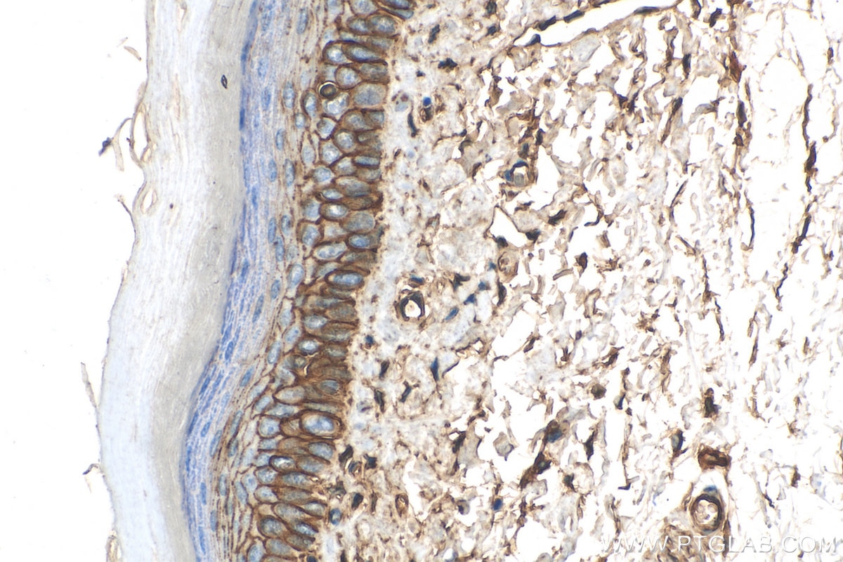 Immunohistochemistry (IHC) staining of mouse skin tissue using S100A10 Recombinant antibody (81017-1-RR)