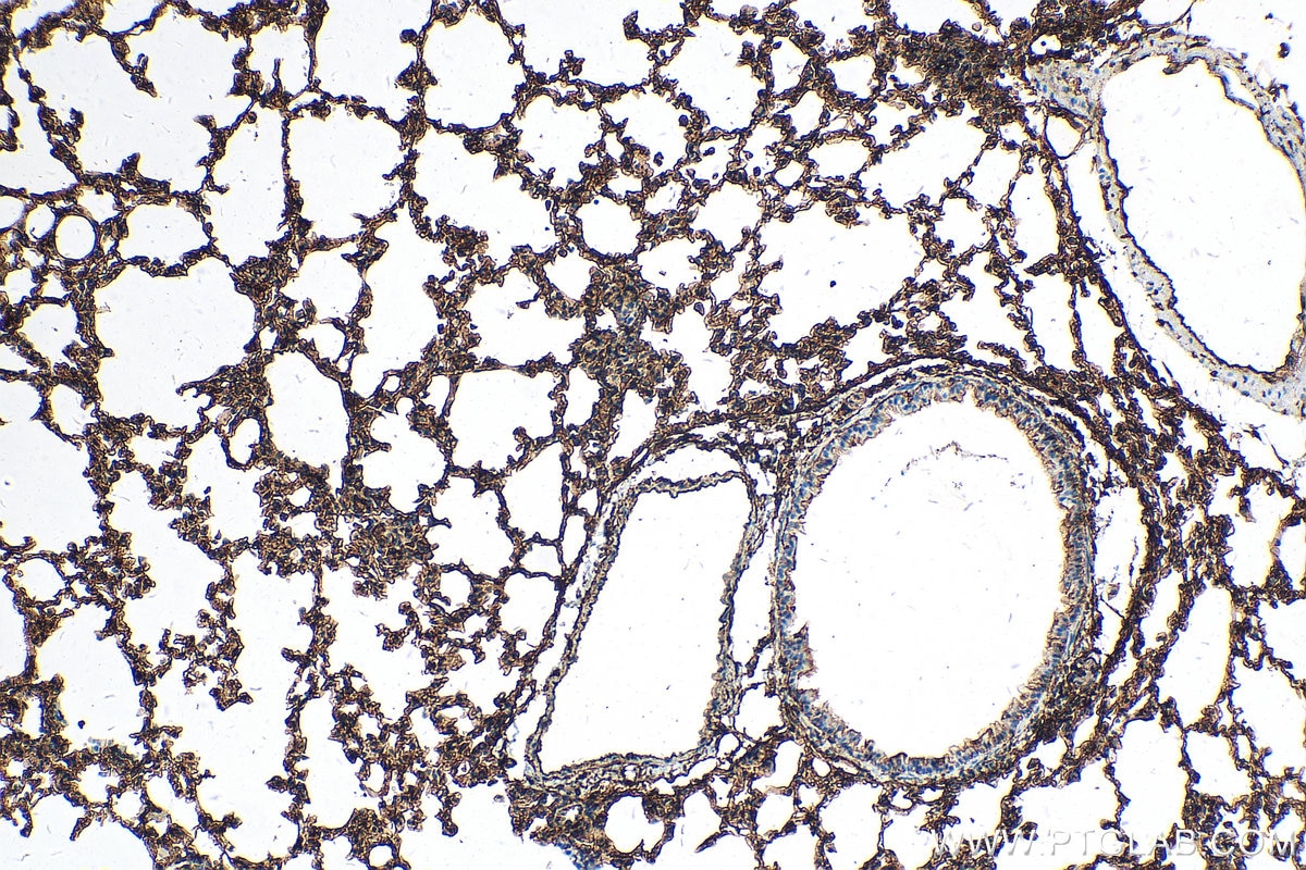 Immunohistochemistry (IHC) staining of mouse lung tissue using S100A10 Recombinant antibody (81017-1-RR)