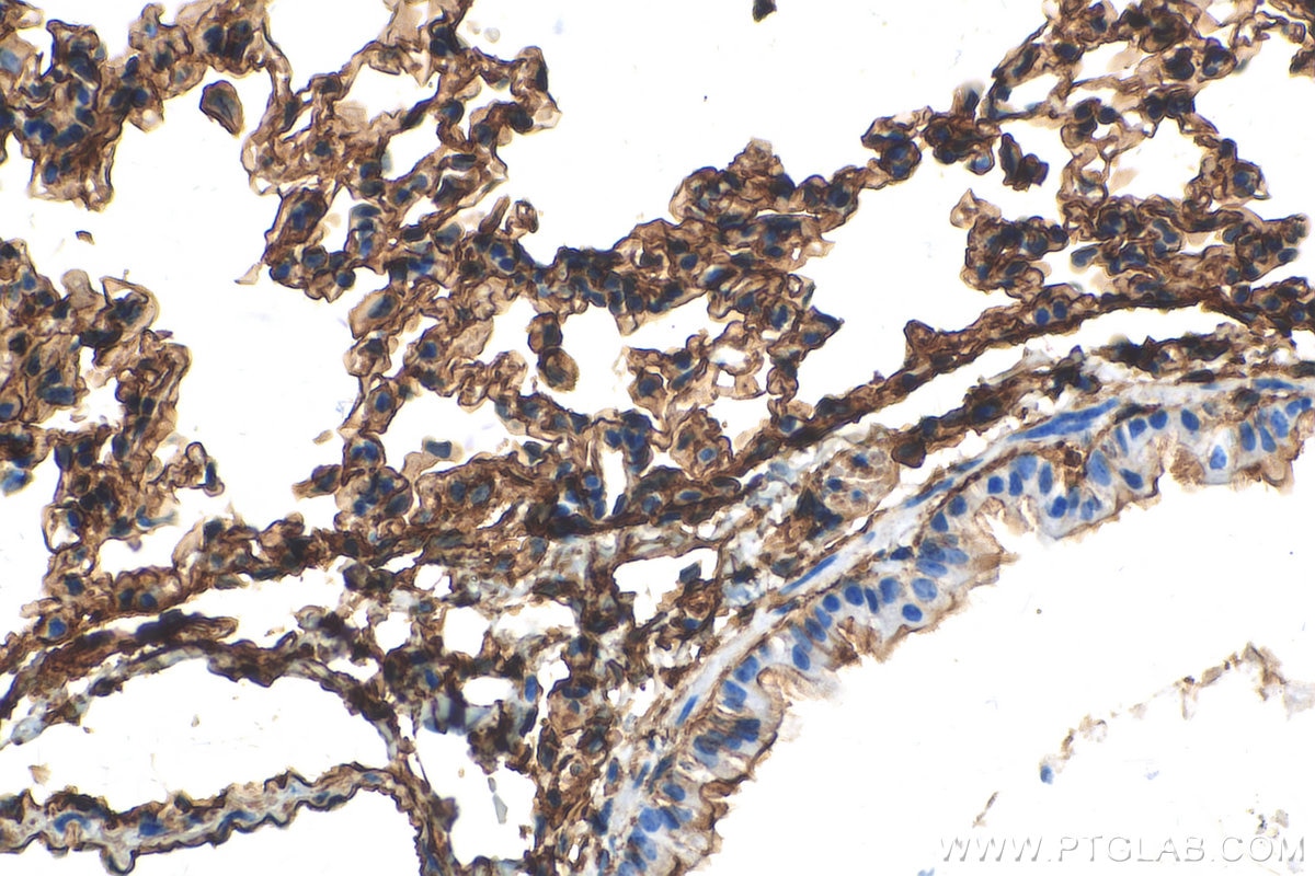 Immunohistochemistry (IHC) staining of mouse lung tissue using S100A10 Recombinant antibody (81017-1-RR)