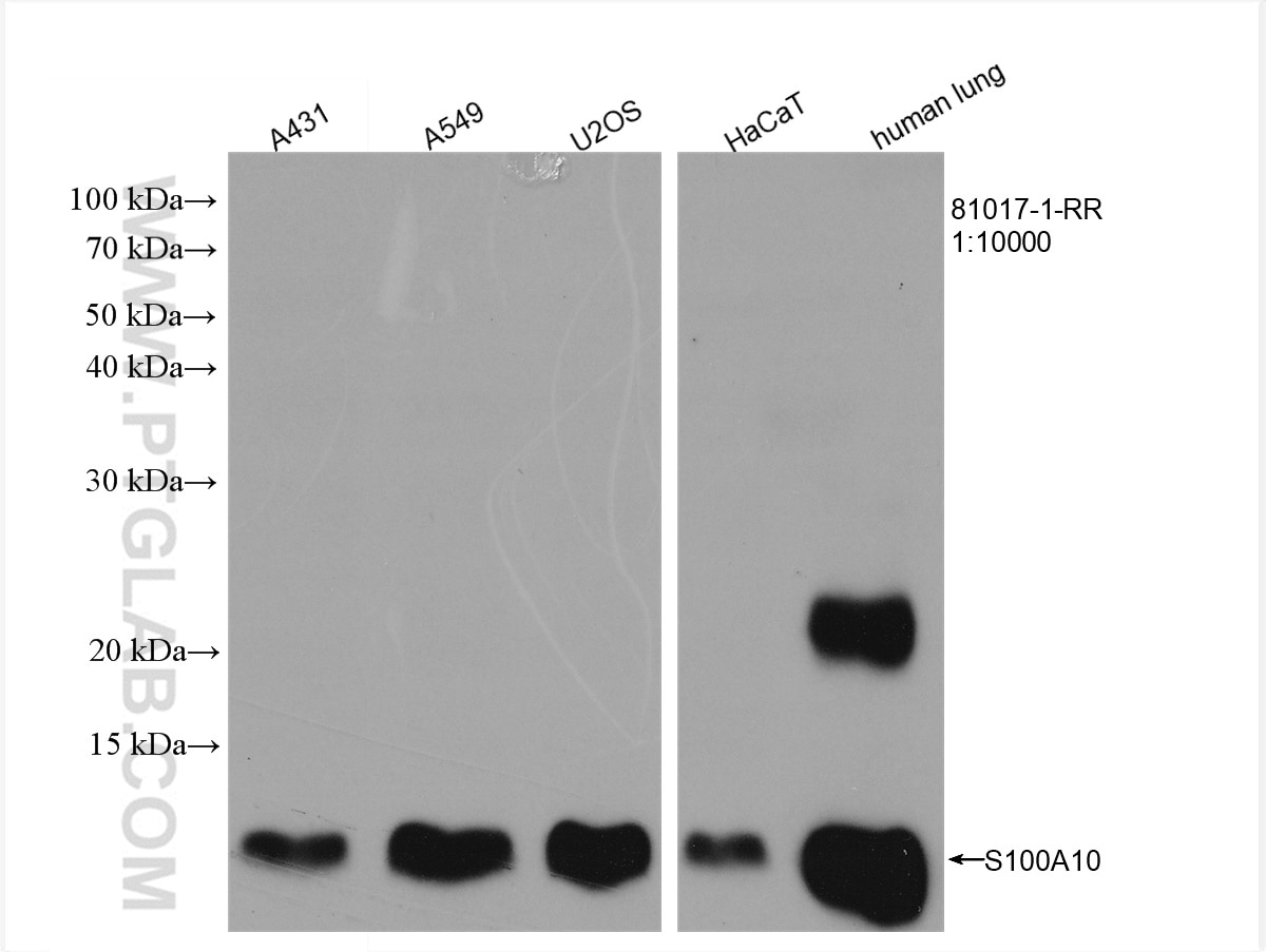 Western Blot (WB) analysis of A431 cells using S100A10 Recombinant antibody (81017-1-RR)