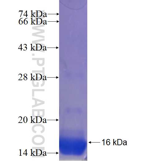 S100A10 fusion protein Ag23596 SDS-PAGE