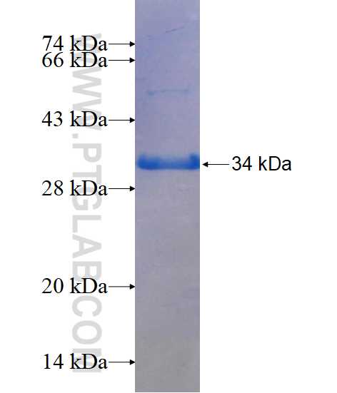 S100A10 fusion protein Ag1779 SDS-PAGE
