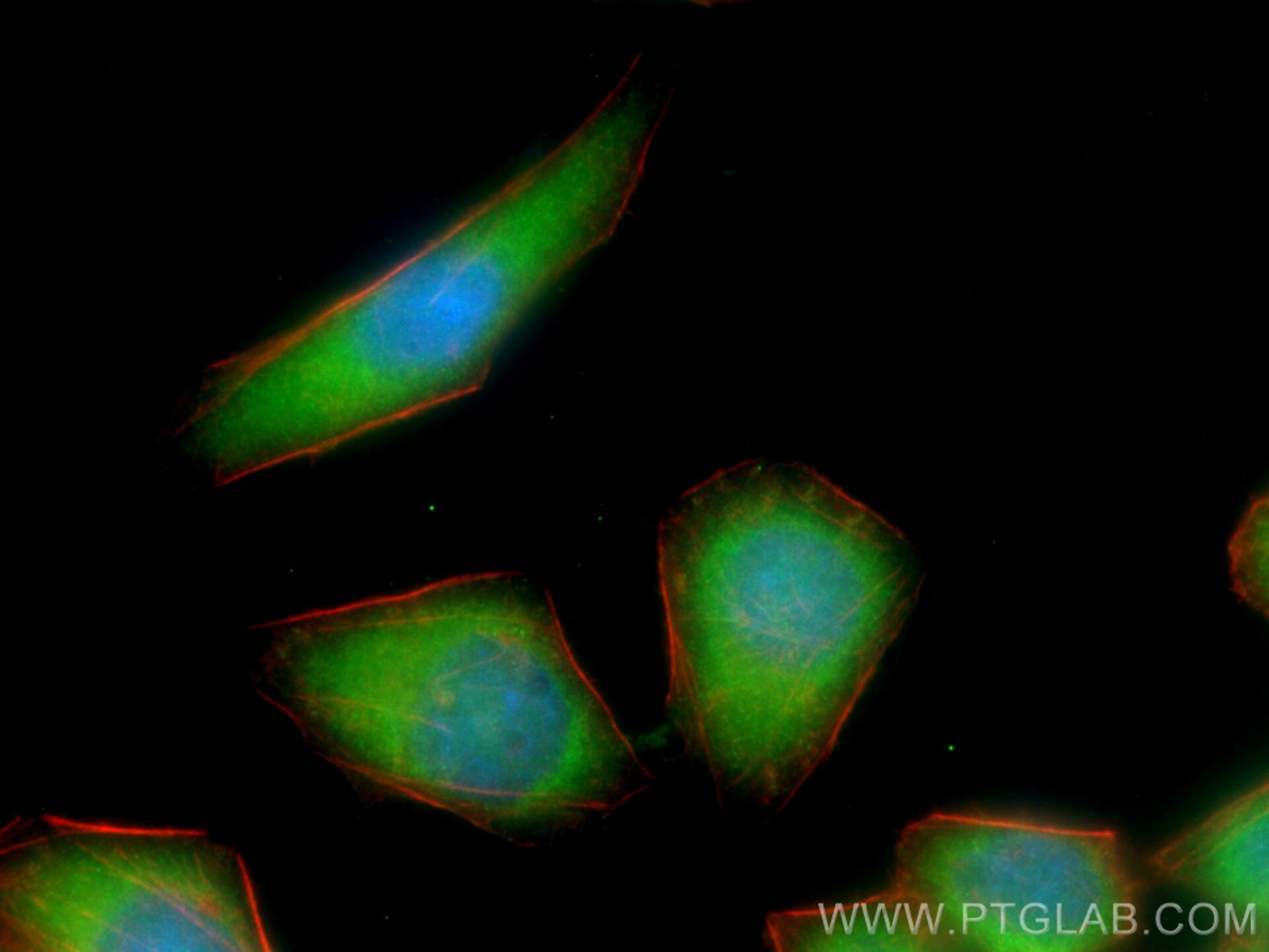 Immunofluorescence (IF) / fluorescent staining of PC-3 cells using S100A11 Polyclonal antibody (10237-1-AP)