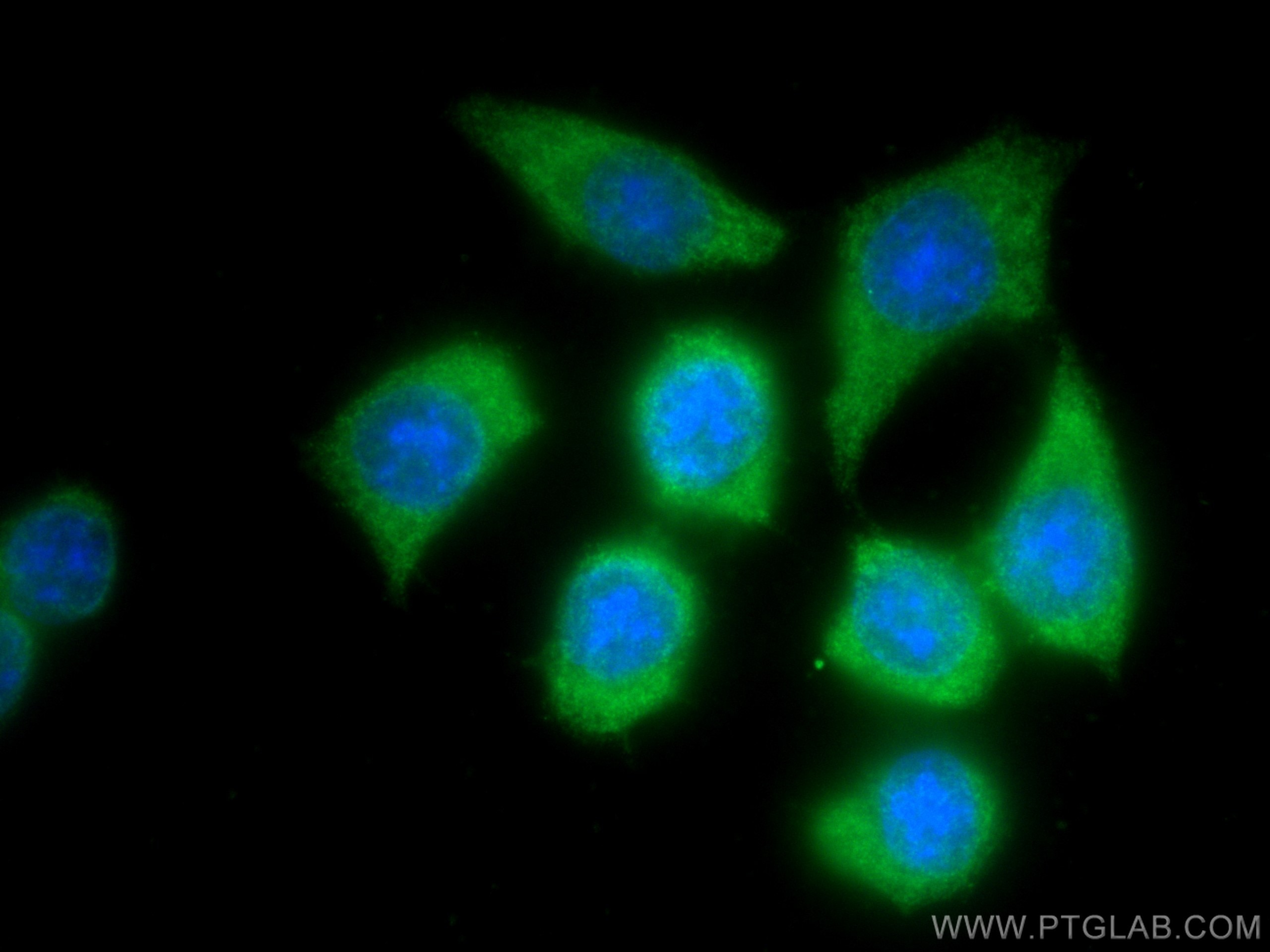 Immunofluorescence (IF) / fluorescent staining of BxPC-3 cells using S100A11 Polyclonal antibody (10237-1-AP)