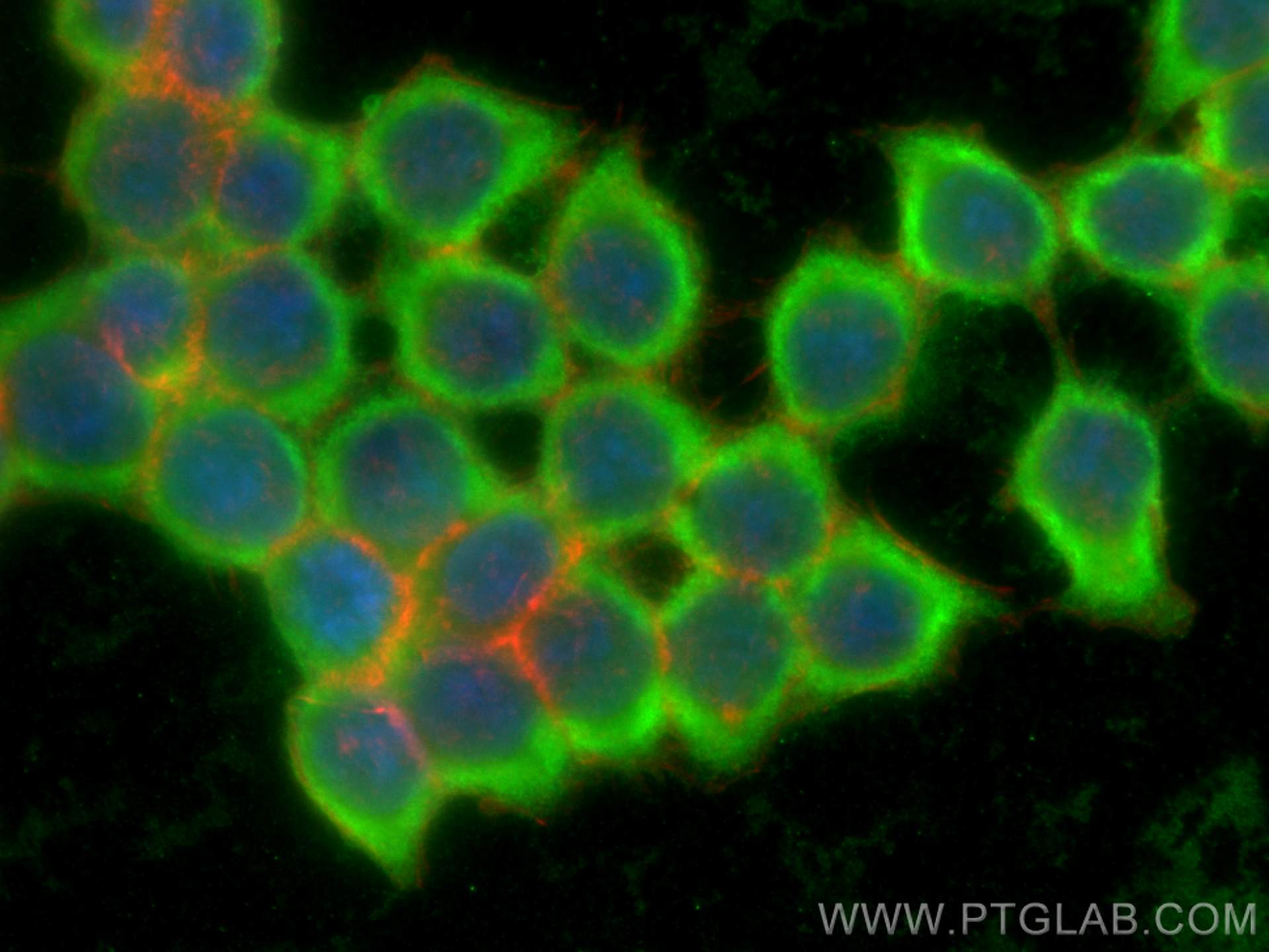 Immunofluorescence (IF) / fluorescent staining of BxPC-3 cells using S100A11 Polyclonal antibody (10237-1-AP)