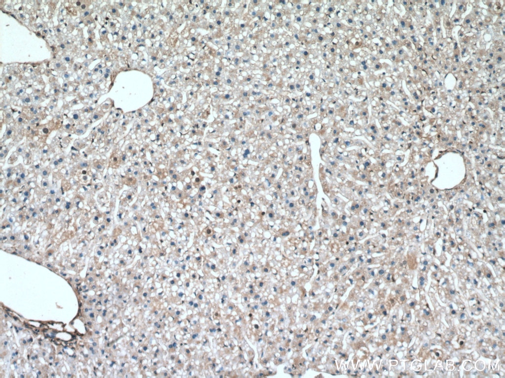 Immunohistochemistry (IHC) staining of mouse liver tissue using S100A11 Polyclonal antibody (10237-1-AP)
