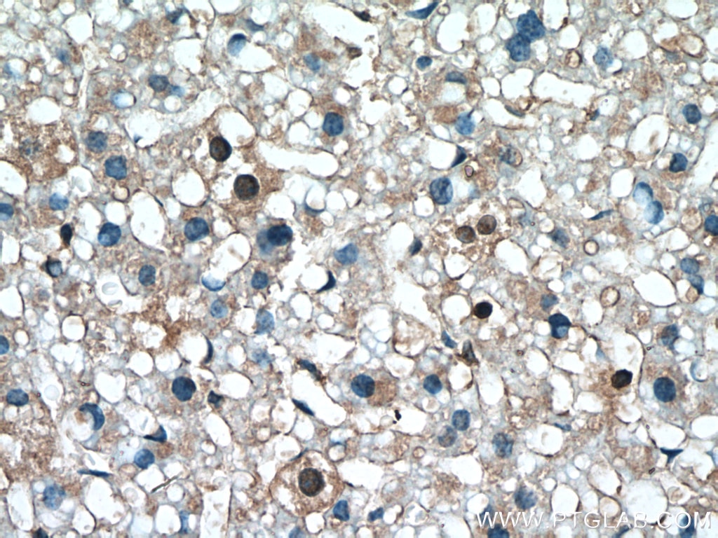 Immunohistochemistry (IHC) staining of mouse liver tissue using S100A11 Polyclonal antibody (10237-1-AP)