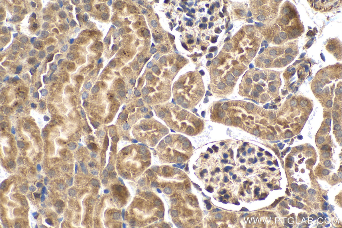 Immunohistochemistry (IHC) staining of mouse kidney tissue using S100A11 Polyclonal antibody (10237-1-AP)