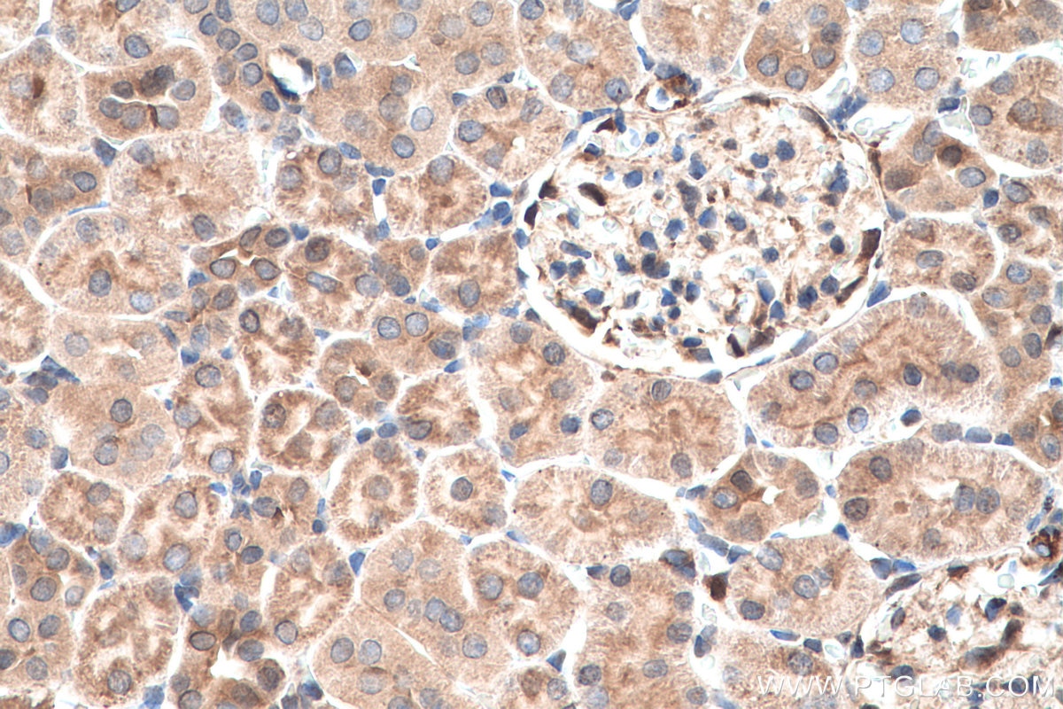 Immunohistochemistry (IHC) staining of rat kidney tissue using S100A11 Polyclonal antibody (10237-1-AP)