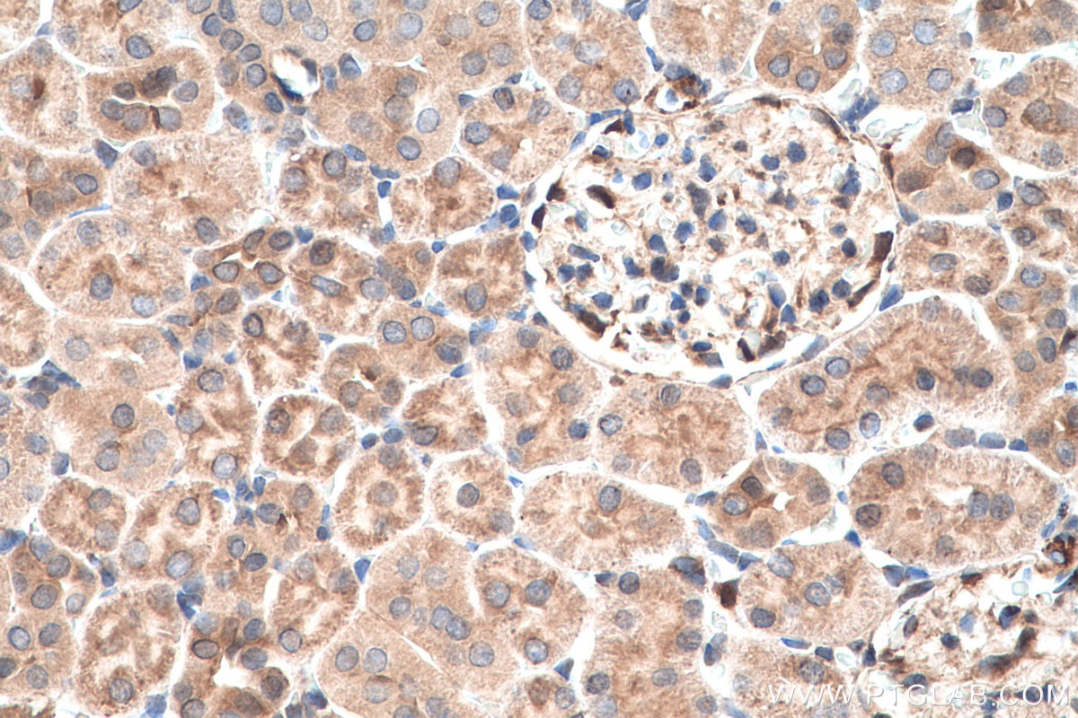 IHC staining of rat kidney using 10237-1-AP