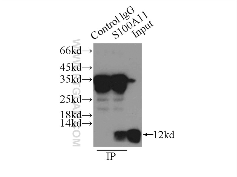 Immunoprecipitation (IP) experiment of PC-3 cells using S100A11 Polyclonal antibody (10237-1-AP)