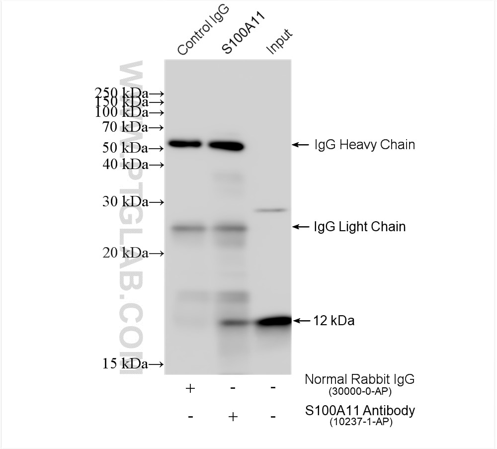 Immunoprecipitation (IP) experiment of DU 145 cells using S100A11 Polyclonal antibody (10237-1-AP)