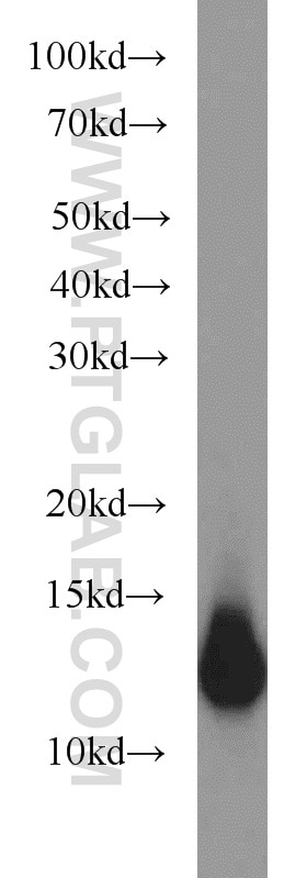 WB analysis of PC-3 using 10237-1-AP