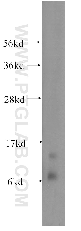 Western Blot (WB) analysis of COLO 320 cells using S100A11 Polyclonal antibody (10237-1-AP)