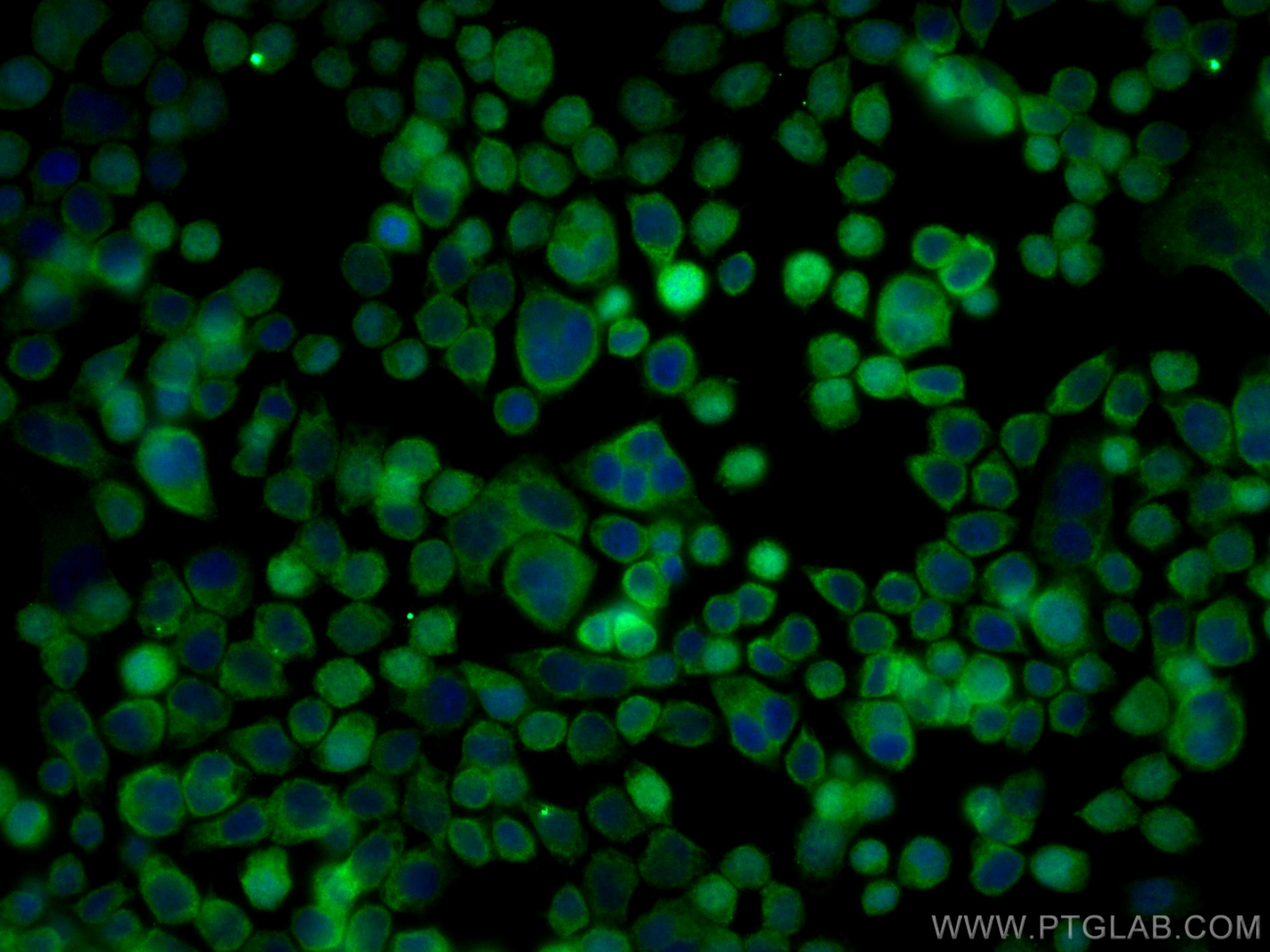 Immunofluorescence (IF) / fluorescent staining of BxPC-3 cells using S100A11 Monoclonal antibody (60024-1-Ig)