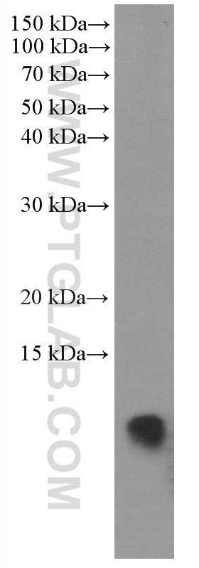 Western Blot (WB) analysis of T-47D cells using S100A11 Monoclonal antibody (60024-1-Ig)