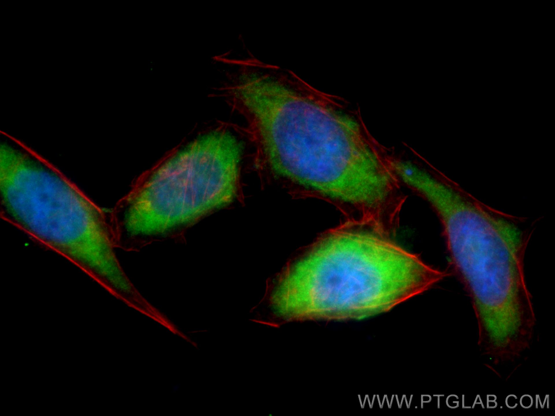 Immunofluorescence (IF) / fluorescent staining of PC-3 cells using CoraLite® Plus 488-conjugated S100A11 Polyclonal a (CL488-10237)