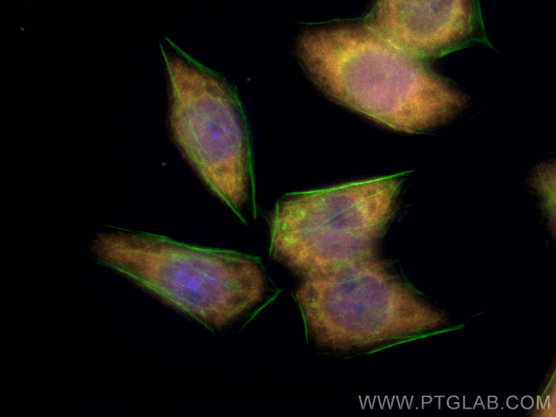 Immunofluorescence (IF) / fluorescent staining of PC-3 cells using CoraLite®555-conjugated S100A11 Polyclonal antibod (CL555-10237)